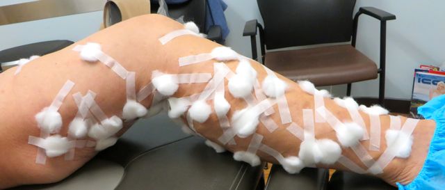 I also had a busy day my my doctor. I ws turned into a pin chs
